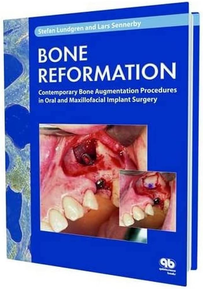 Bone Reformation