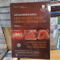 Image of Atlas berwarna lesi mulut yang sering ditemukan E-4