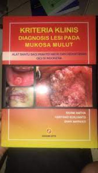 Image of Kriteria Klinis Diagnosis Lesi pada Mukosa Mulut : Alat Bantu Bagi Praktisi Medis dan Kedokteran Gigi di Indonesia