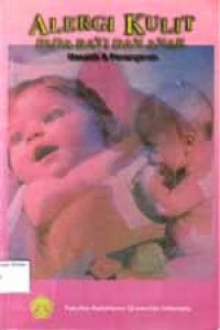Image of Alergi Kulit pada Bayi dan Anak; Masalah & penanganannya
