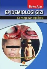 Image of Buku Ajar Epidemiologi Gizi Konsep Dan Aplikasi