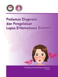 Image of Diagnosis dan pengelolaan lupus eritematosus sistemik