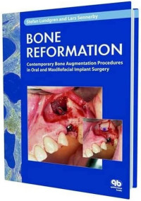 Image of Bone Reformation